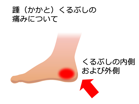 踵（かかと）くるぶしの痛みについて 【十三なかばやし整骨院】淀川区十三で自律神経整体改善・25年の経験、12万人